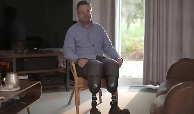 Sigorta tazminatı için ayaklarını kesti